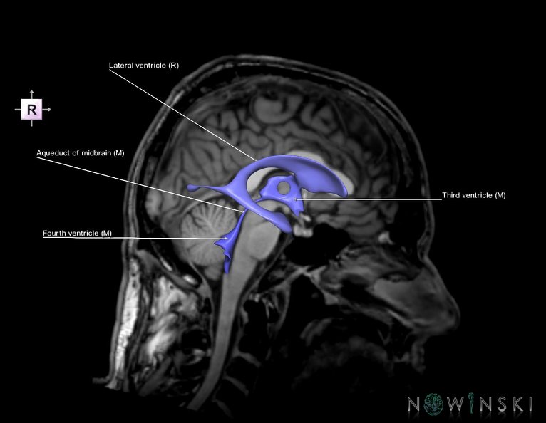 G6.T12.V4.P00S.Cerebral_ventricles–Triplanar.tiff