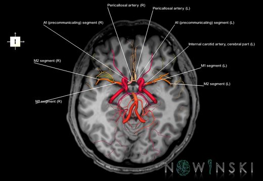 G6.T15.2.V6.P-10S.Intracranial arteries–Triplanar