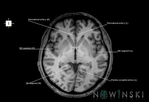 G6.T15.2.V6.P00.Intracranial arteries–Triplanar