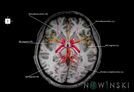 G6.T15.2.V6.P00S.Intracranial arteries–Triplanar