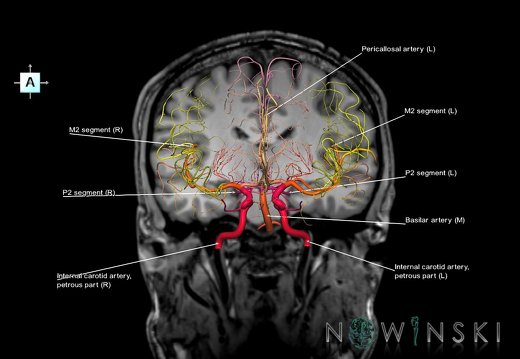 G6.T15.2.V1.P-20S.Intracranial arteries–Triplanar