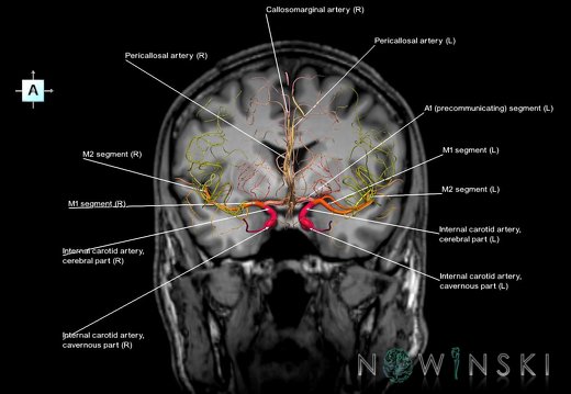 G6.T15.2.V1.P00S.Intracranial arteries–Triplanar