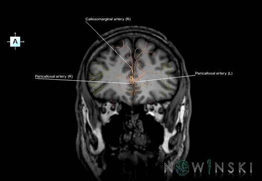 G6.T15.2.V1.P30S.Intracranial arteries–Triplanar