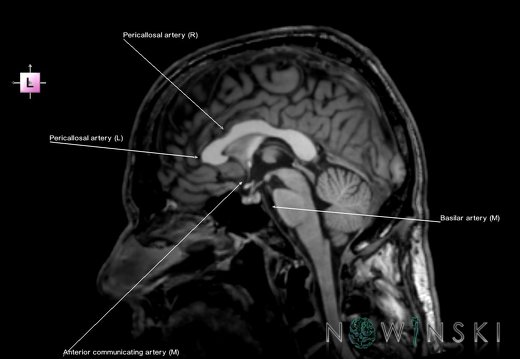 G6.T15.2.V2.P00.Intracranial arteries–Triplanar