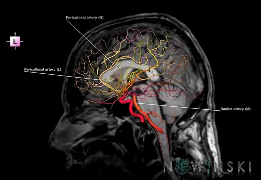 G6.T15.2.V2.P00S.Intracranial arteries–Triplanar