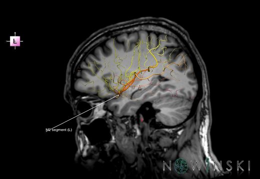 G6.T15.2.V2.P30S.Intracranial arteries–Triplanar