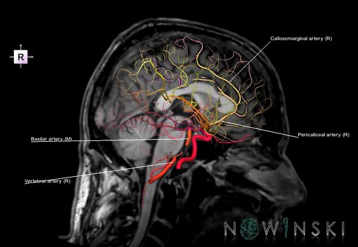 G6.T15.2.V4.P00S.Intracranial arteries–Triplanar