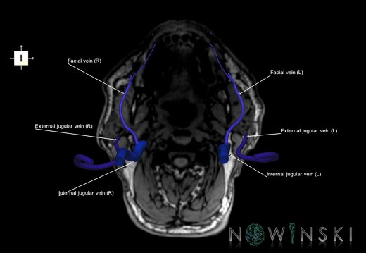 G6.T18.2.V6.P-100S.Extracranial veins–Triplanar