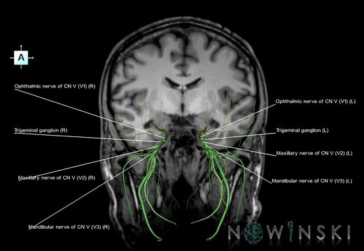 G6.T19.8.V1.P-09S.Trigeminal nerve–Triplanar