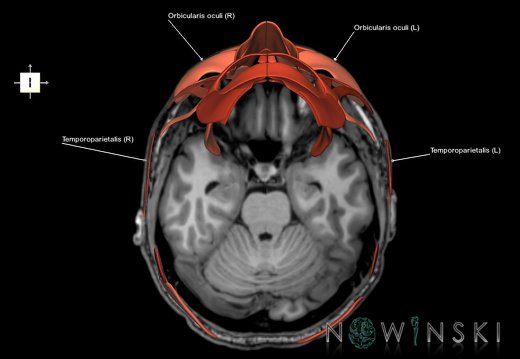 G6.T20.5.V6.P-20S.Facial muscles–Triplanar