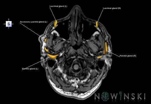 G6.T21.V5.P-60S.Glands–Triplanar