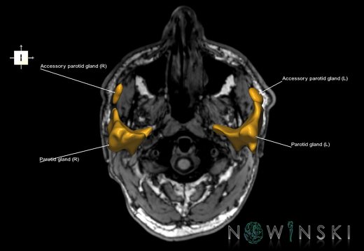 G6T21.Glands–Triplanar