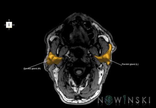 G6.T21.V6.P-90S.Glands–Triplanar