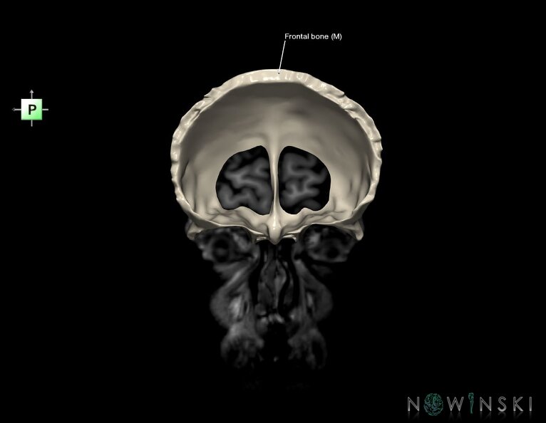 G6.T22.5.3.V4.P60S.Frontal_bone–Triplanar.tiff