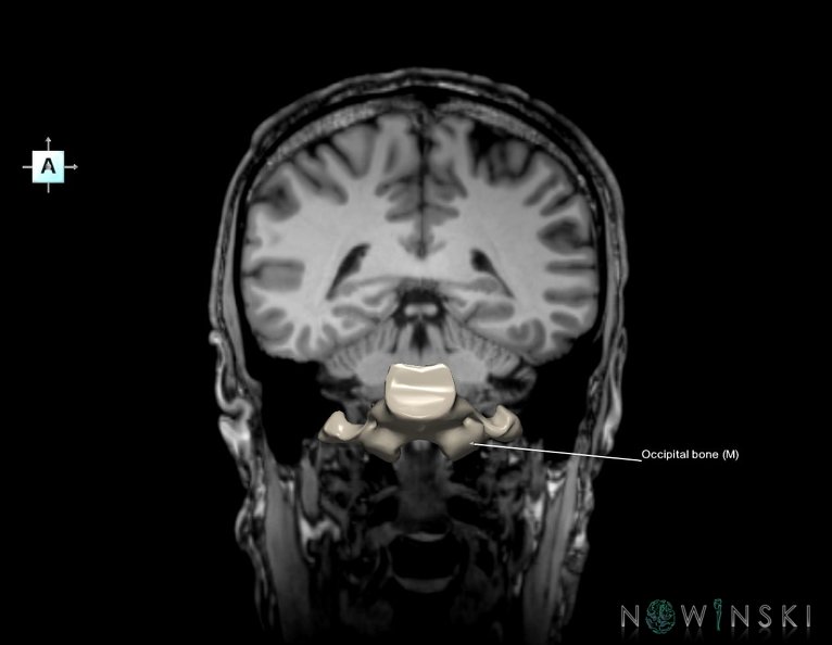 G6.T22.5.6.V1.P-40S.Occipital_bone–Triplanar.tiff