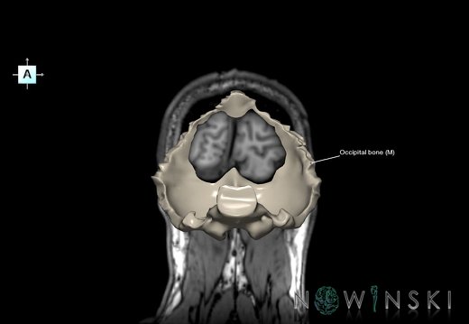 G6T22.5.6.OccipitalBone–Triplanar