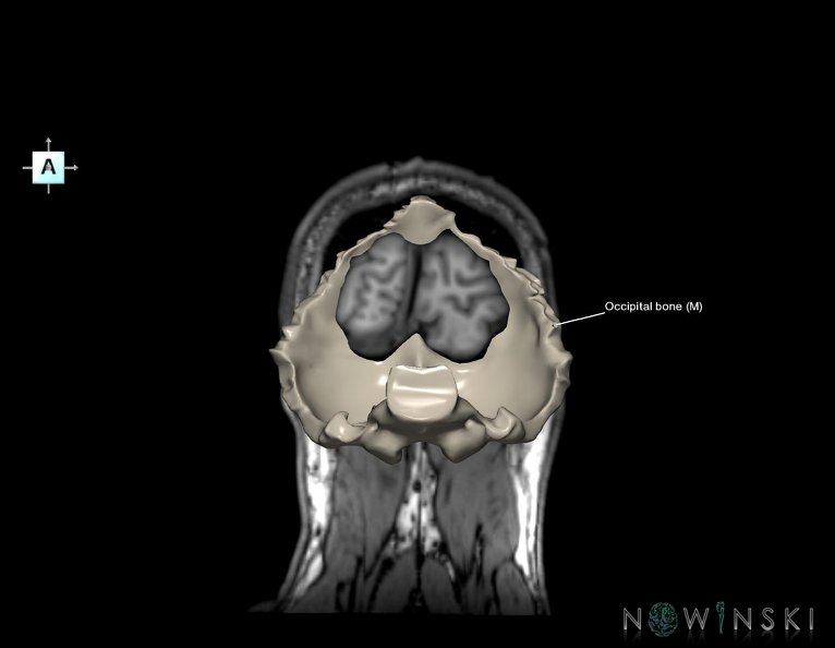 G6.T22.5.6.V1.P-90S.Occipital_bone–Triplanar.tiff