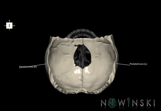 G6.T22.5.7.V6.P70S.Parietal bone–Triplanar