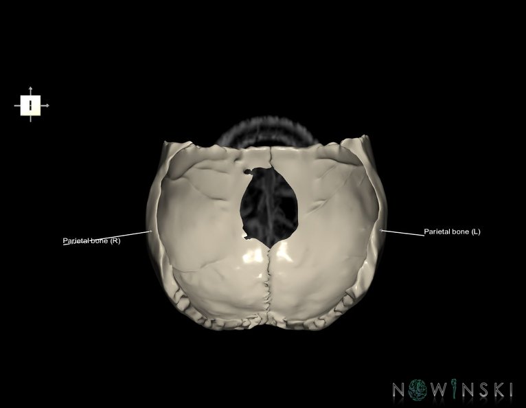 G6.T22.5.7.V6.P70S.Parietal_bone–Triplanar.tiff