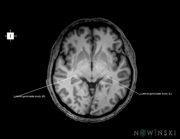 G6.T26.V6.P-03.Visual_system–Triplanar.tiff