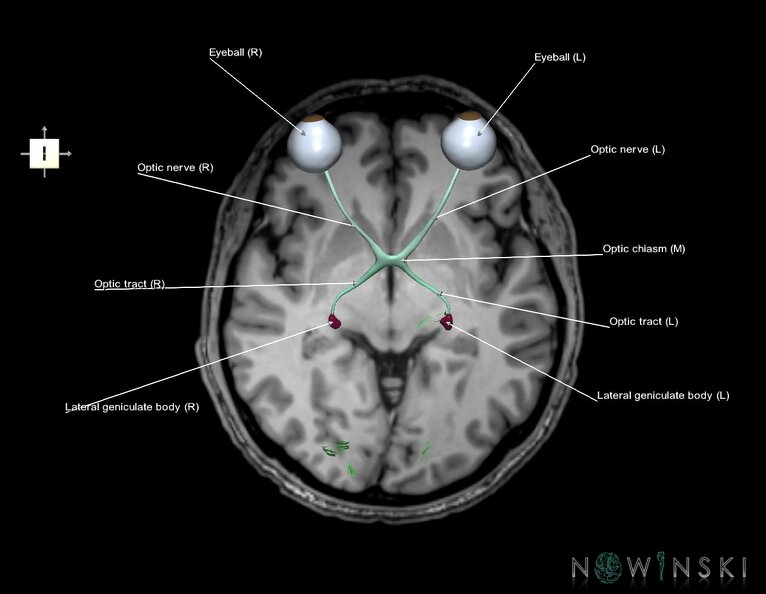 G6.T26.V6.P-03S.Visual_system–Triplanar.tiff