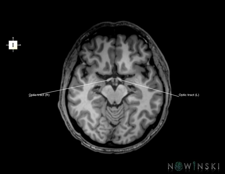 G6.T26.V6.P-10.Visual_system–Triplanar.tiff