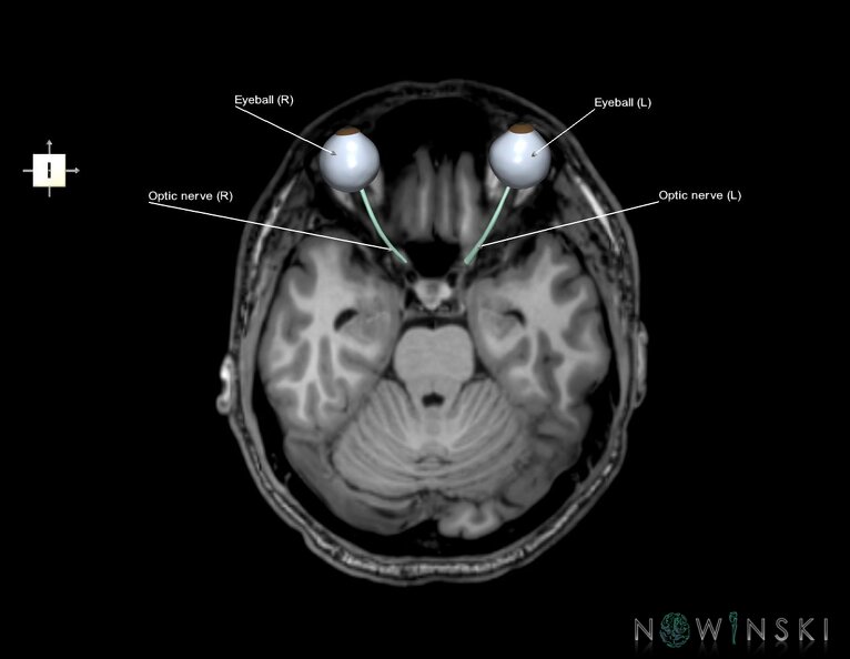 G6.T26.V6.P-20S.Visual_system–Triplanar.tiff