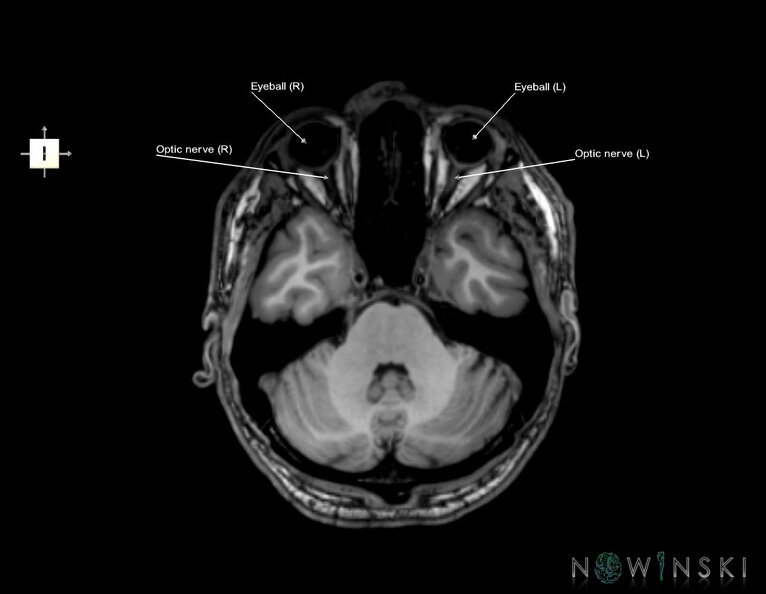 G6.T26.V6.P-30.Visual_system–Triplanar.tiff
