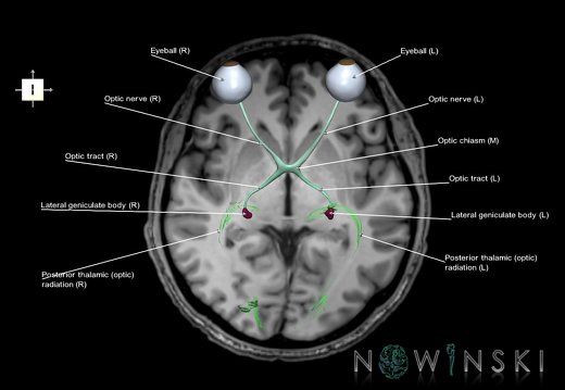 G6.T26.V6.P00S.Visual system–Triplanar