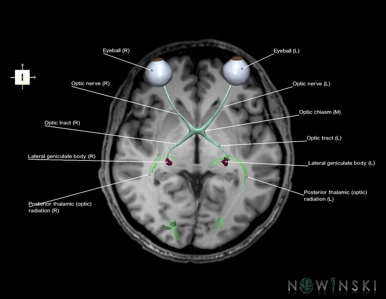 G6.T26.V6.P00S.Visual_system–Triplanar.tiff
