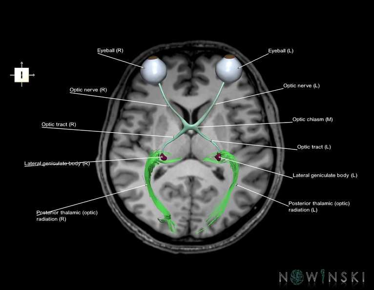 G6.T26.V6.P10S.Visual_system–Triplanar.tiff