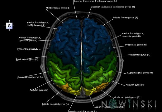 G6T3.1.Cerebrum–TriplanarAxial