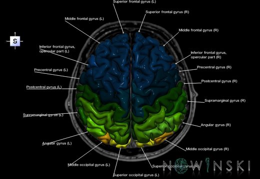 G6.T3.1.V5.P30S.Cerebrum–Triplanar