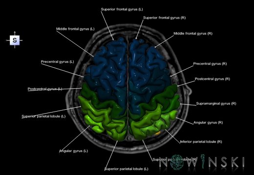 G6.T3.1.V5.P40S.Cerebrum–Triplanar