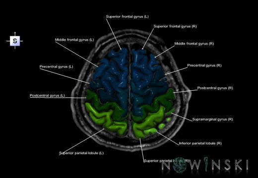 G6.T3.1.V5.P50S.Cerebrum–Triplanar