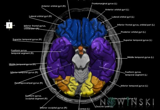 G6.T3.1.V6.P-10S.Cerebrum–Triplanar