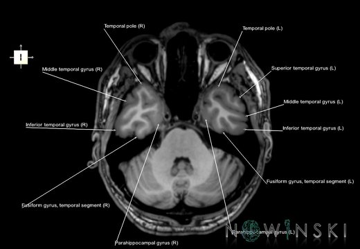 G6.T3.1.V6.P-30.Cerebrum–Triplanar