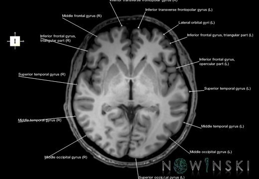 G6.T3.1.V6.P00.Cerebrum–Triplanar