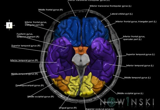 G6.T3.1.V6.P00S.Cerebrum–Triplanar