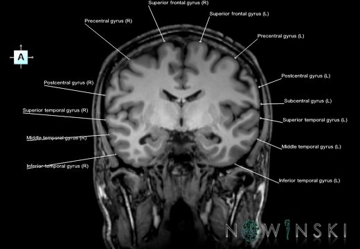 G6.T3.1.V1.P-10.Cerebrum–Triplanar