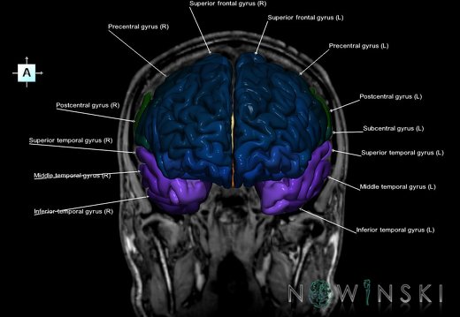 G6.T3.1.V1.P-10S.Cerebrum–Triplanar