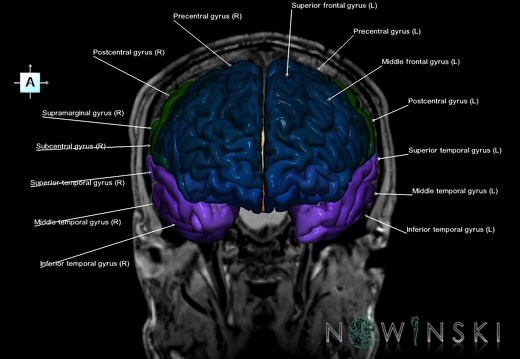 G6.T3.1.V1.P-20S.Cerebrum–Triplanar