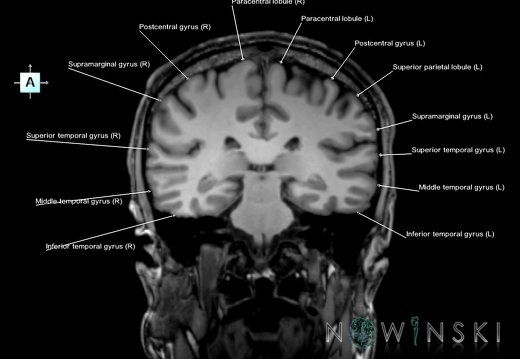 G6.T3.1.V1.P-30.Cerebrum–Triplanar