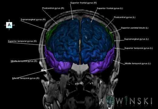 G6.T3.1.V1.P-30S.Cerebrum–Triplanar