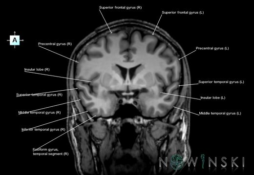 G6.T3.1.V1.P00.Cerebrum–Triplanar