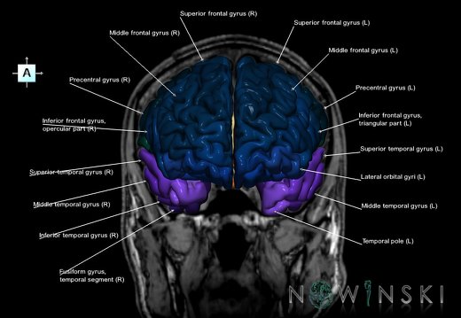 G6.T3.1.V1.P00S.Cerebrum–Triplanar