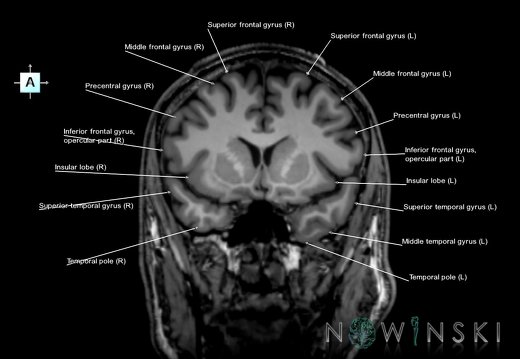 G6.T3.1.V1.P10.Cerebrum–Triplanar