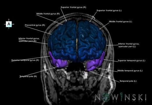 G6.T3.1.V1.P10S.Cerebrum–Triplanar