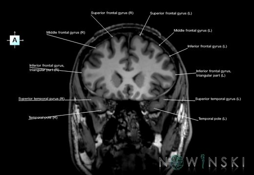 G6.T3.1.V1.P20.Cerebrum–Triplanar