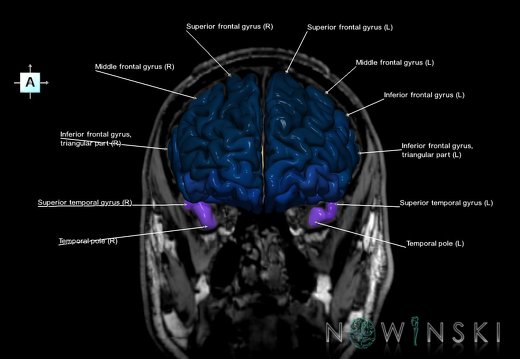 G6.T3.1.V1.P20S.Cerebrum–Triplanar